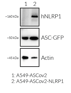 NLRP1 and ASC-GFP expression (Western blot)