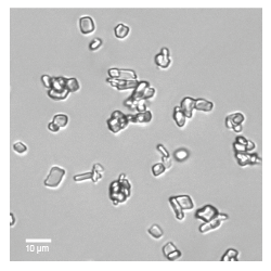 Microscopic analysis of Cholesterol Crystals