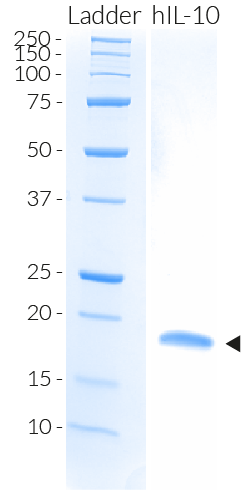Human IL-10 detection by SDS-PAGE