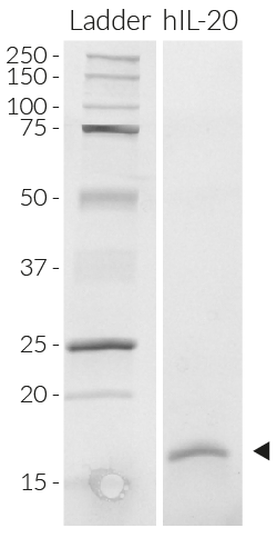 Human IL-20 SDS-PAGE analysis