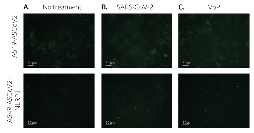 ASC speck formation upon NLRP1 inflammasome activation (without hTNF-α stimulation)