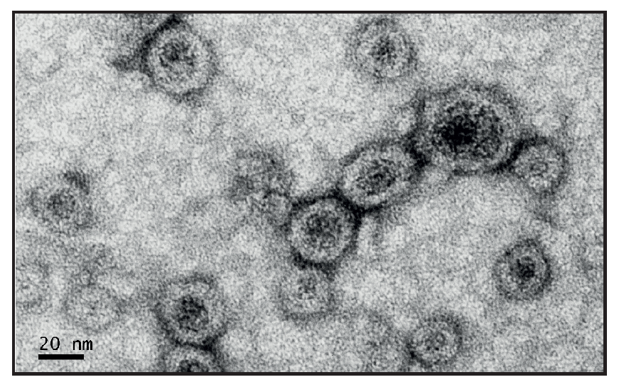 Characterization of E. coli OMVs by TEM