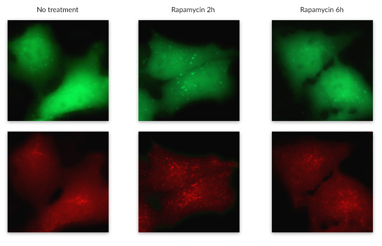 Detection of fluorescent puncta from rapamycin-mediated autophagy in Hela-Difluo cells