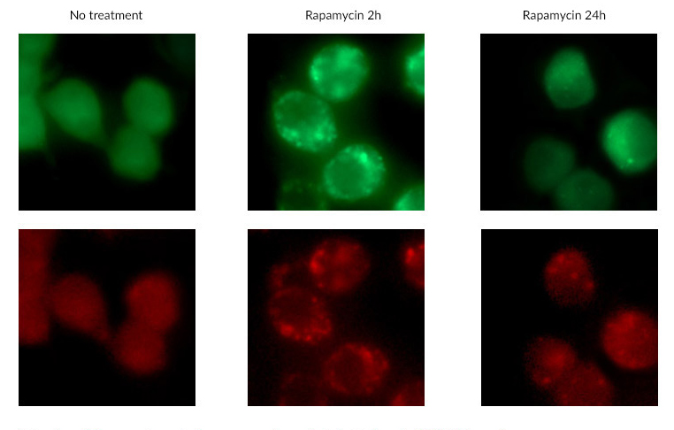 Detection of fluorescent puncta from rapamycin-mediated autophagy