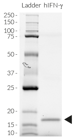 Detection by SDS-PAGE