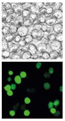 Transfection of a GFP-expressing plasmid
