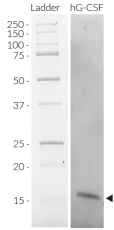 Recombinant human G-CSF detection by SDS-PAGE
