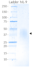 Human IL-9 SDS-PAGE analysis Human IL-9 SDS-PAGE analysis