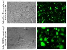 Infection of A549-hACE2-TMPRSS2 cells by SARS-CoV-2 Spike pseudotyped lentiviral particles