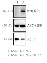 NLRP1 and ASC-GFP expression (Western blot)