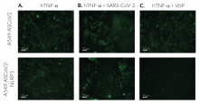 ASC speck formation upon NLRP1 inflammasome activation (with hTNF-α stimulation)