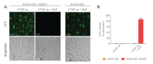 Monitoring of ASC speck formation and pyroptosis upon NLRP1 activation using Val-boroPro