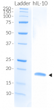 Detection by SDS-PAGE