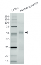 Nucleocaspid-His purity analysis by SDS-PAGE