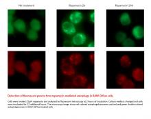 Detection of fluorescent puncta from rapamycin-mediated autophagy