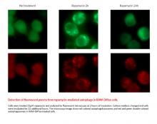 Detection of fluorescent puncta from rapamycin-mediated autophagy