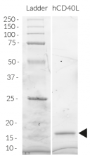 Detection by SDS-PAGE