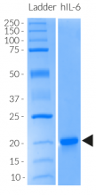 Detection by SDS-PAGE