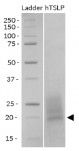 Detection by SDS-PAGE
