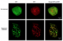 Detection of autophagic fluorescent puncta