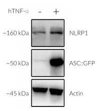 Validation of NLRP1 and inducible ASC::GFP expression