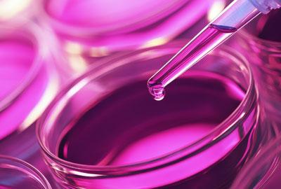 Cell culture Cell culture