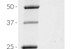 Detection of E. coli-derived IL-1β by SDS-PAGE