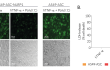 Monitoring of ASC speck formation and pyroptosis upon NLRP1 activation using Poly(IC) Monitoring of ASC speck formation and pyroptosis upon NLRP1 activation using Poly(IC)