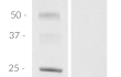 SDS-PAGE analysis of the recombinant mouse (m)IL-4